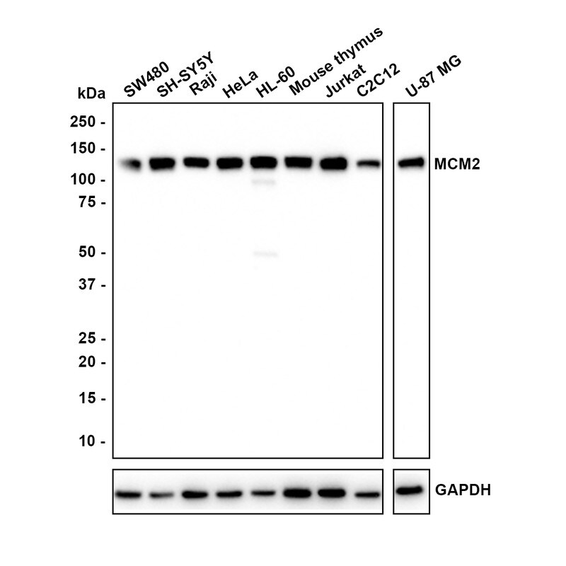 MCM2 Antibody (JE42-39) Western Blot: MCM2 Antibody (JE42-39) [NBP3-32577]