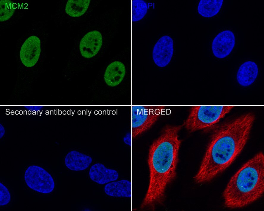MCM2 Antibody (JE42-39)