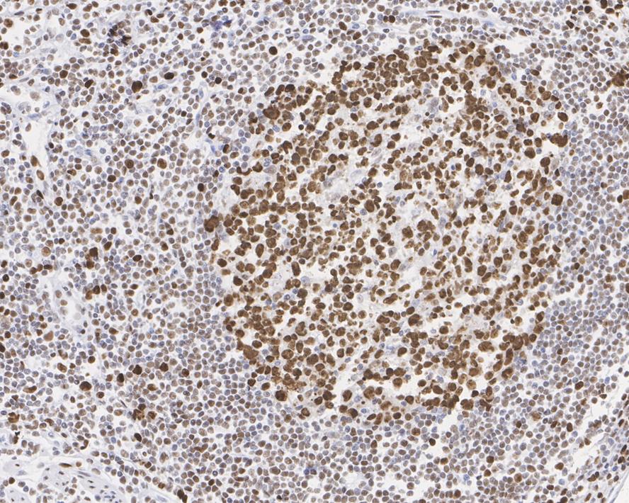 MCM2 Antibody (JE42-39)