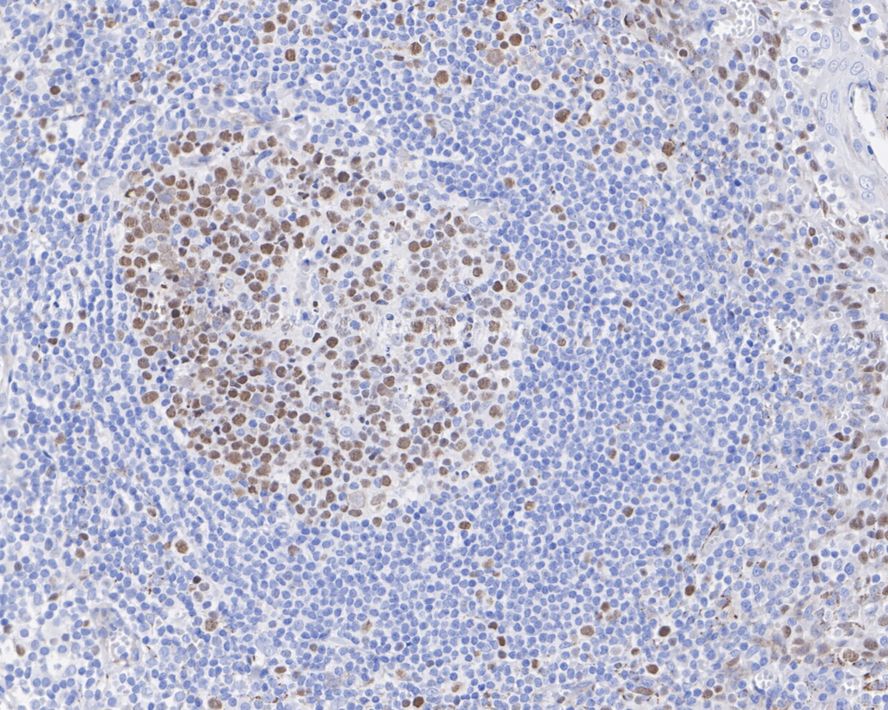 MCM4 Antibody (JE38-76)