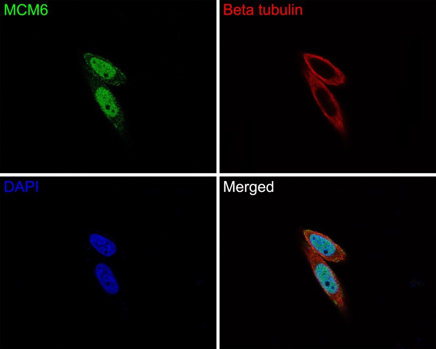 MCM6 Antibody (JE65-68)