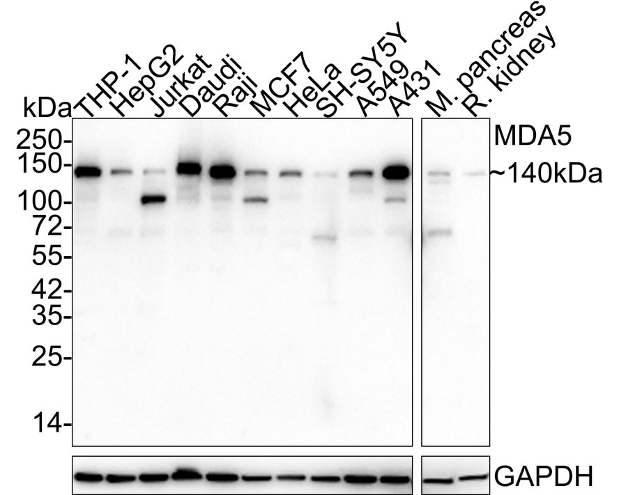 MDA5 Antibody (PSH03-56) Western Blot: MDA5 Antibody (PSH03-56) [NBP3-32581]
