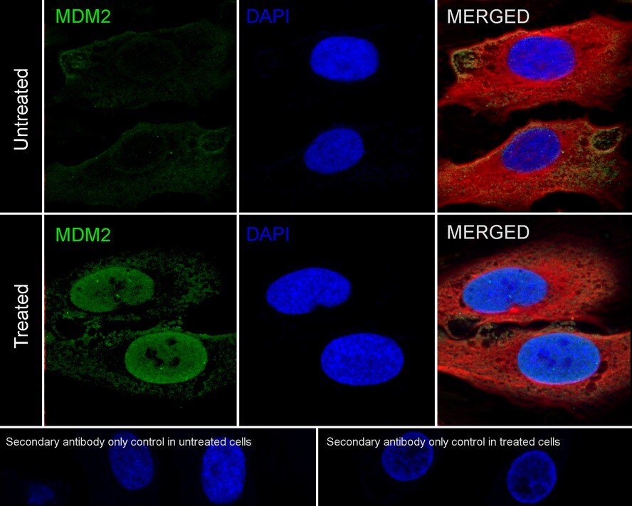 MDM2/HDM2 Antibody (A10E11-R)