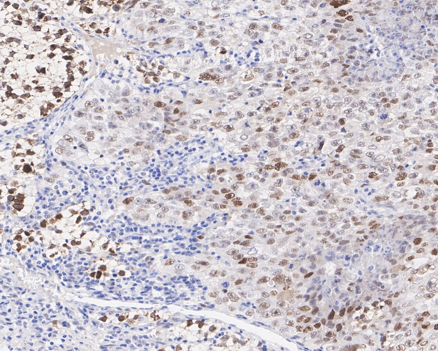 MDM2/HDM2 Antibody (A10E11-R)