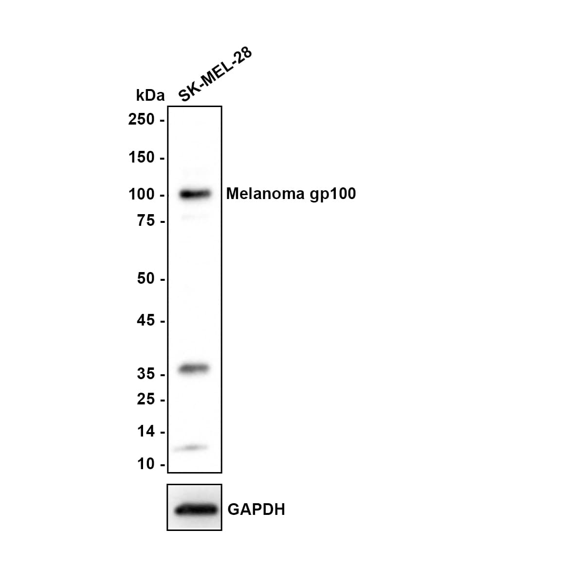 PMEL17/SILV Antibody (JE42-47) Western Blot: PMEL17/SILV Antibody (JE42-47) [NBP3-32586]