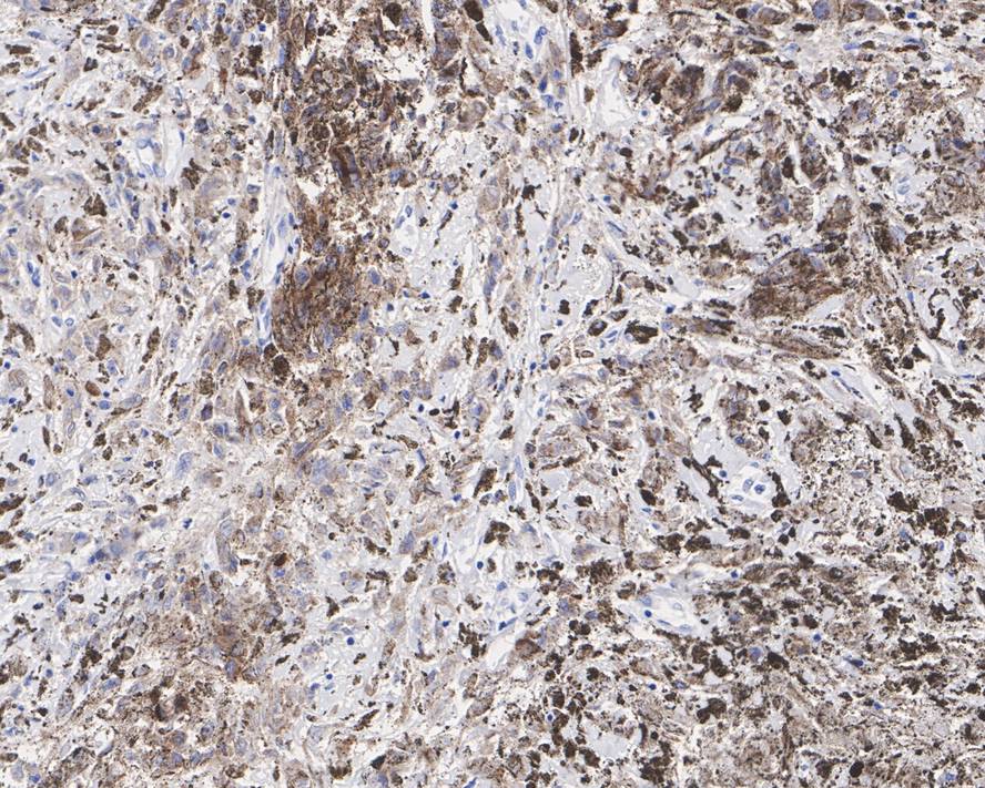 PMEL17/SILV Antibody (JE42-47)