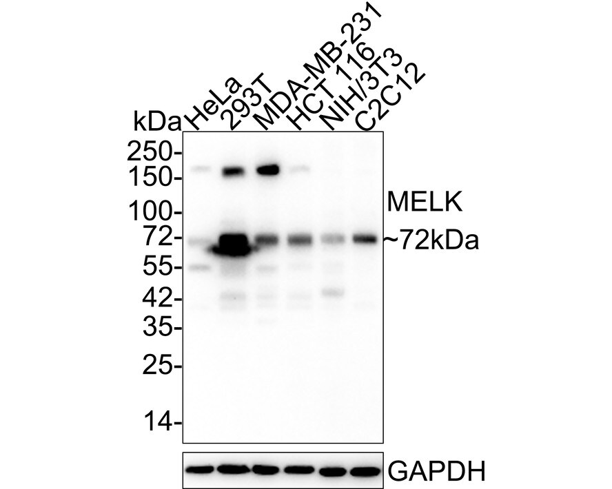 MELK Antibody (PSH03-55) Western Blot: MELK Antibody (PSH03-55) [NBP3-32587]