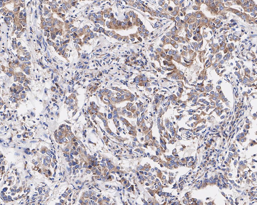 MELK Antibody (PSH03-55)
