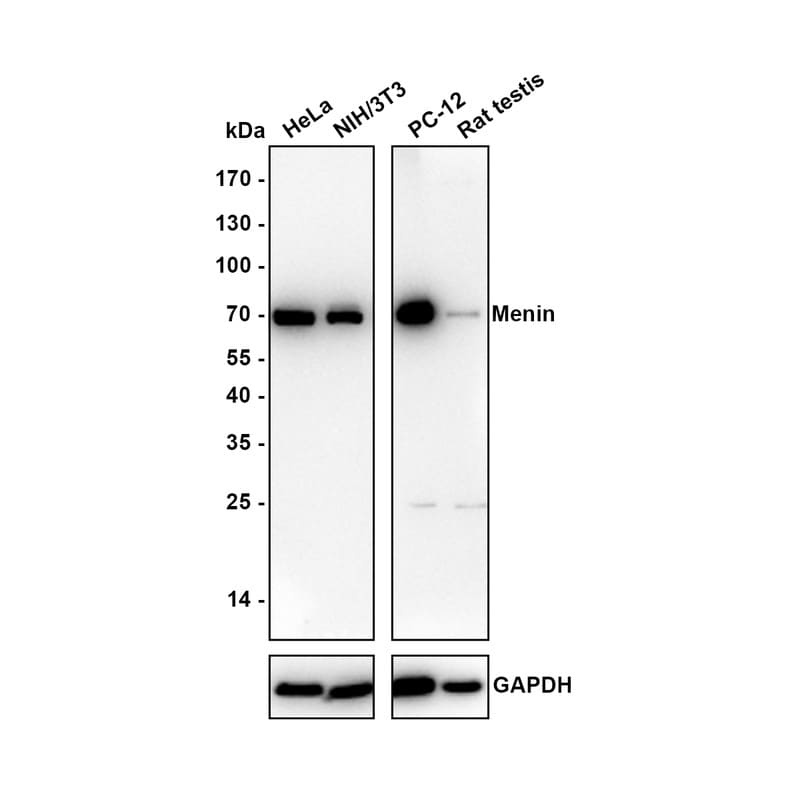 Menin Antibody (JE30-97) Western Blot: Menin Antibody (JE30-97) [NBP3-32588]