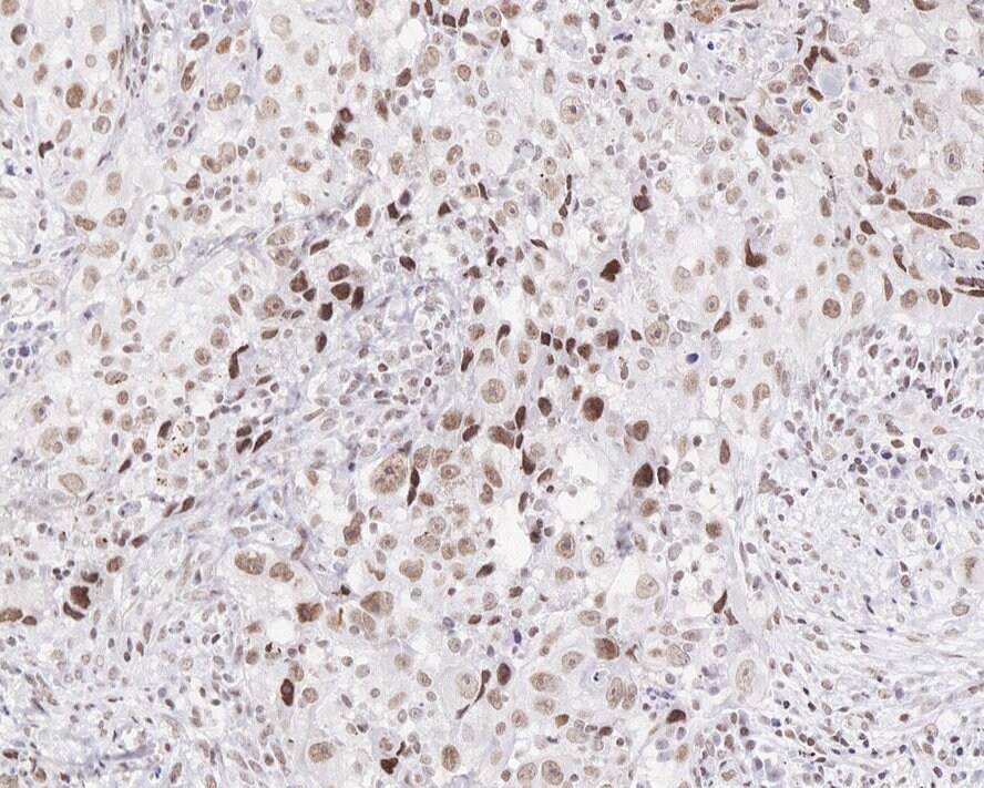 Menin Antibody (JE30-97)