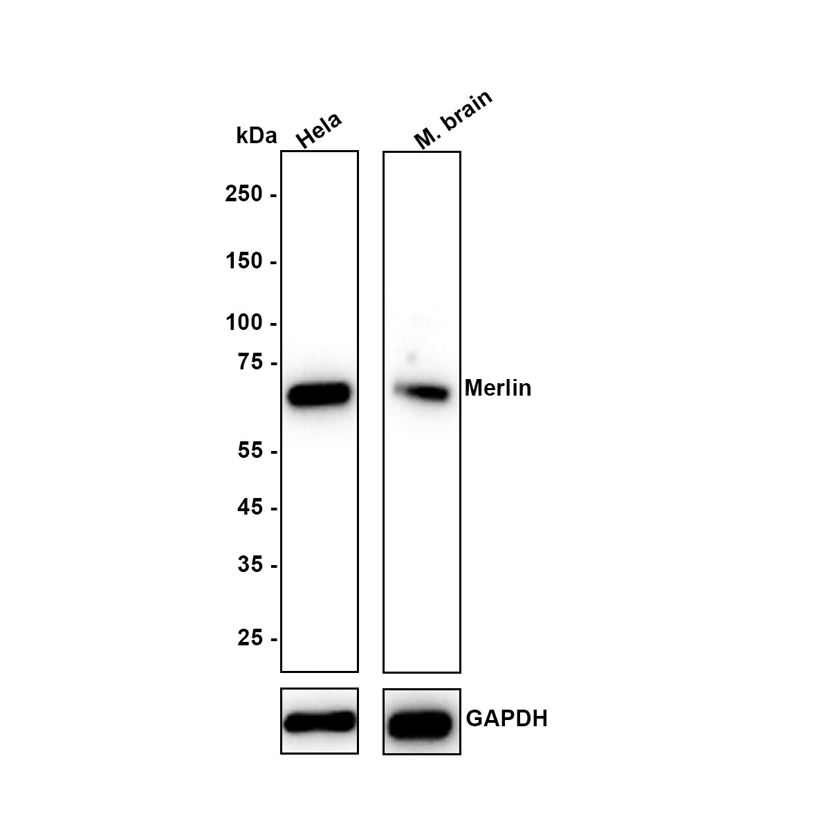 NF2/Merlin Antibody (JE31-02) Western Blot: NF2/Merlin Antibody (JE31-02) [NBP3-32589]