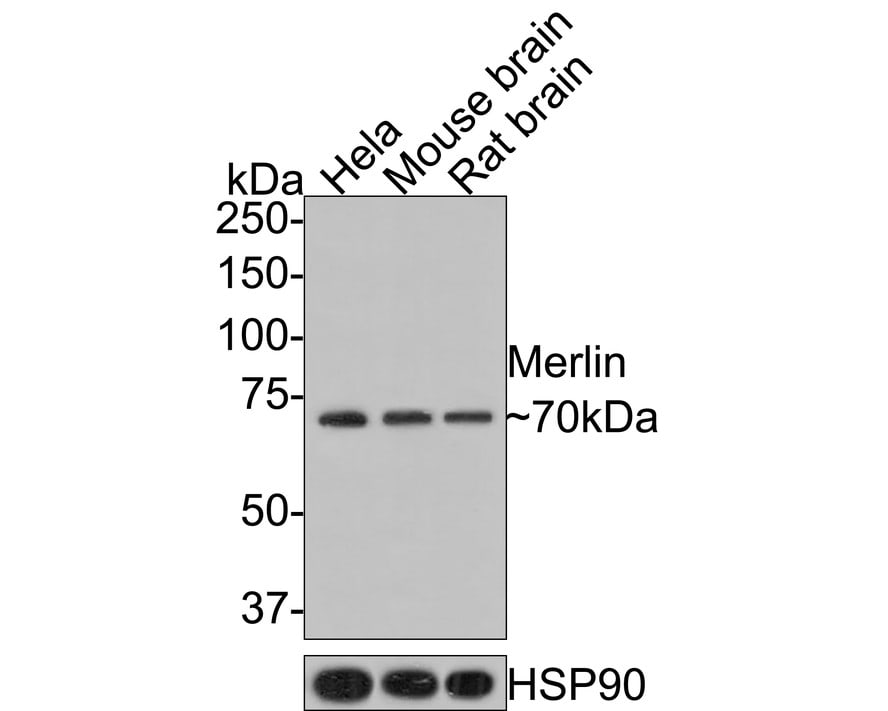 NF2/Merlin Antibody (JE31-02)