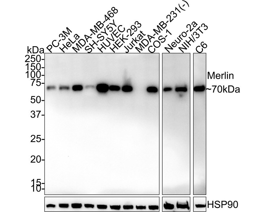 NF2/Merlin Antibody (PSH02-52) Western Blot: NF2/Merlin Antibody (PSH02-52) [NBP3-32590]