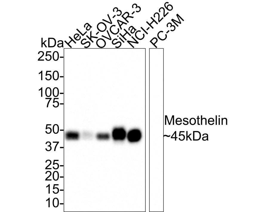 Mesothelin Antibody (PD00-68)