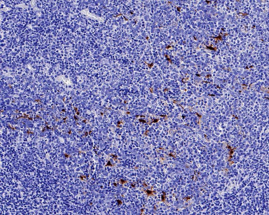 Mesothelin Antibody (PD00-68)