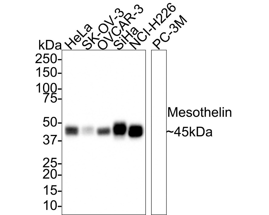 Mesothelin Antibody (PSH0-57)