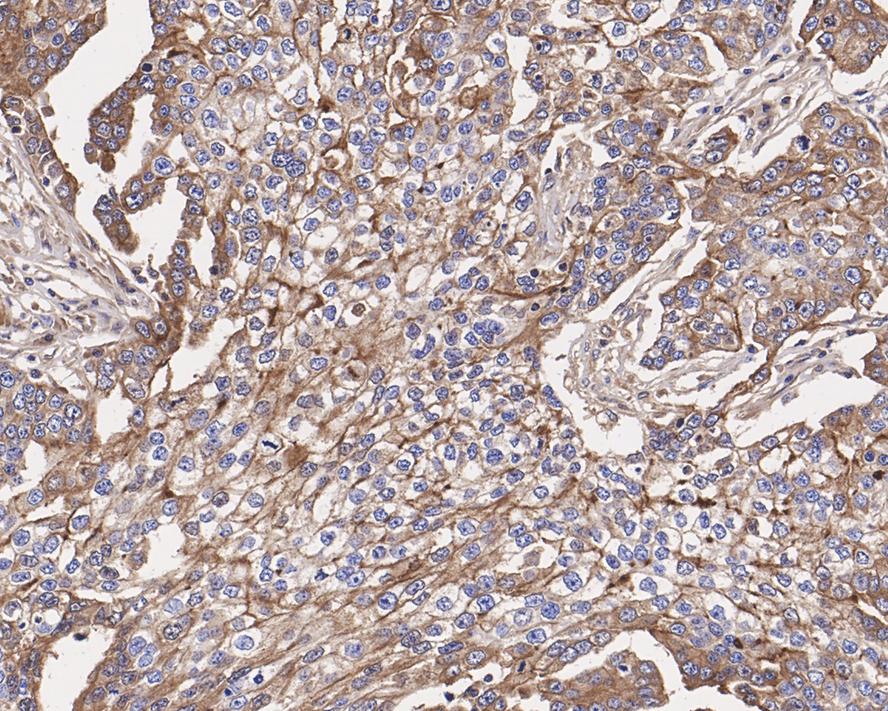 Mesothelin Antibody (PSH0-57)