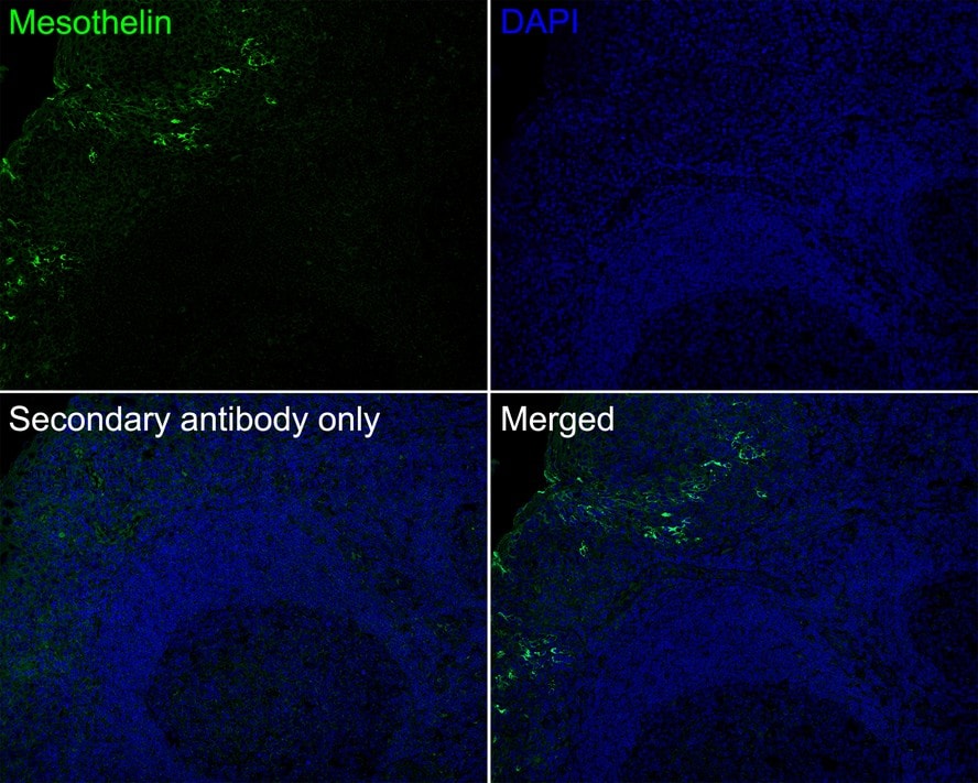 Mesothelin Antibody (PSH0-57)