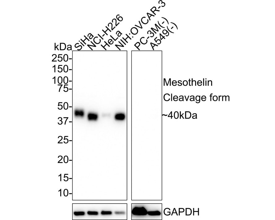 Mesothelin Antibody (PSH02-30) Western Blot: Mesothelin Antibody (PSH02-30) [NBP3-32593]