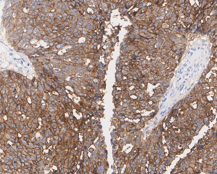Mesothelin Antibody (PSH02-30)