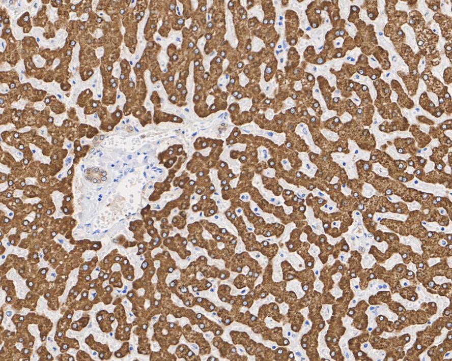 Microsomal Glutathione S-transferase 1 Antibody (14H2-R)