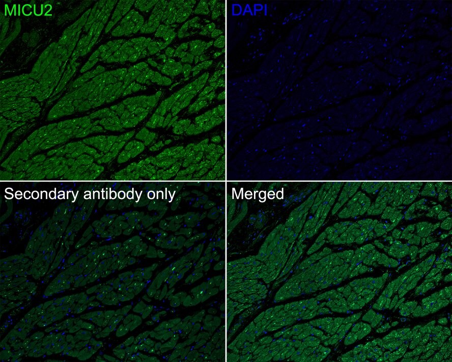 EFHA1 Antibody (PSH01-84)