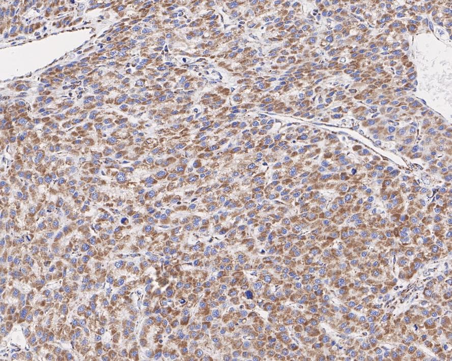 Mitofilin Antibody (PSH01-19)