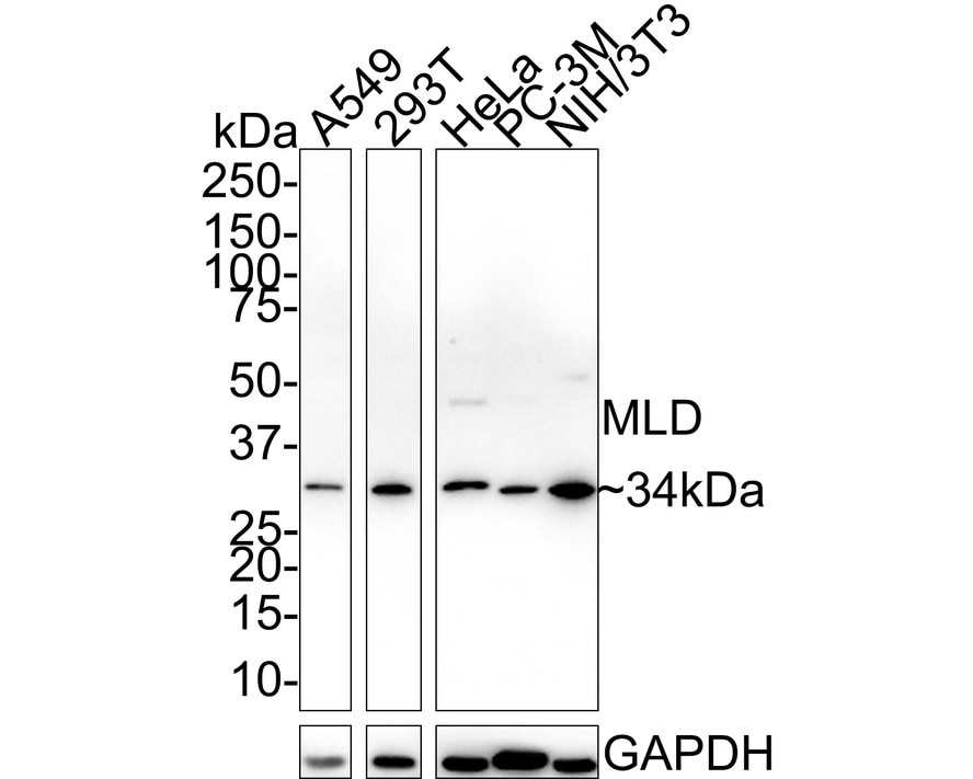 DEGS1 Antibody (PSH02-54)