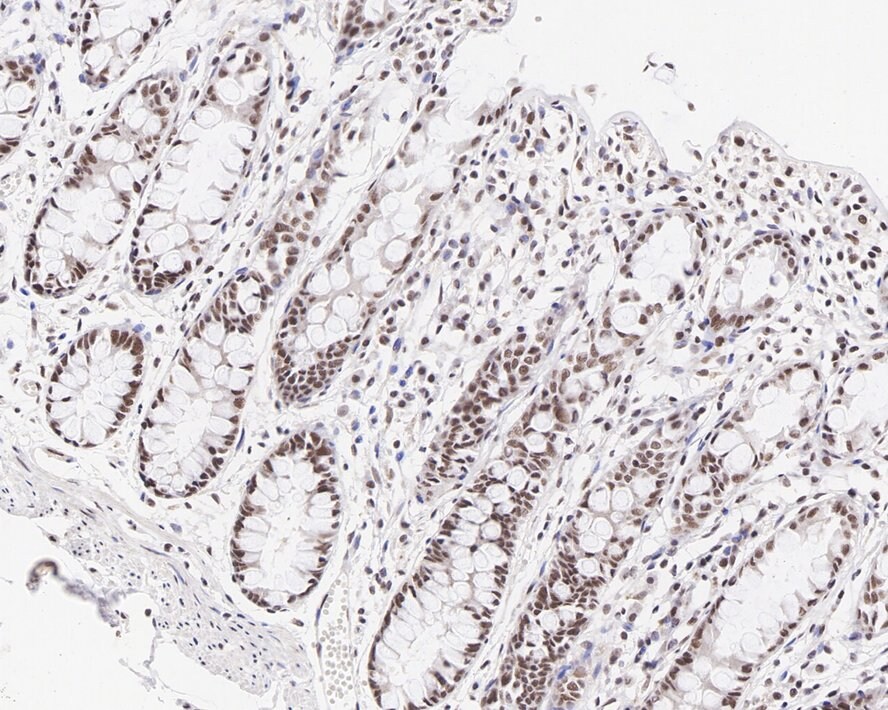 MLH1 Antibody (PD01-61)