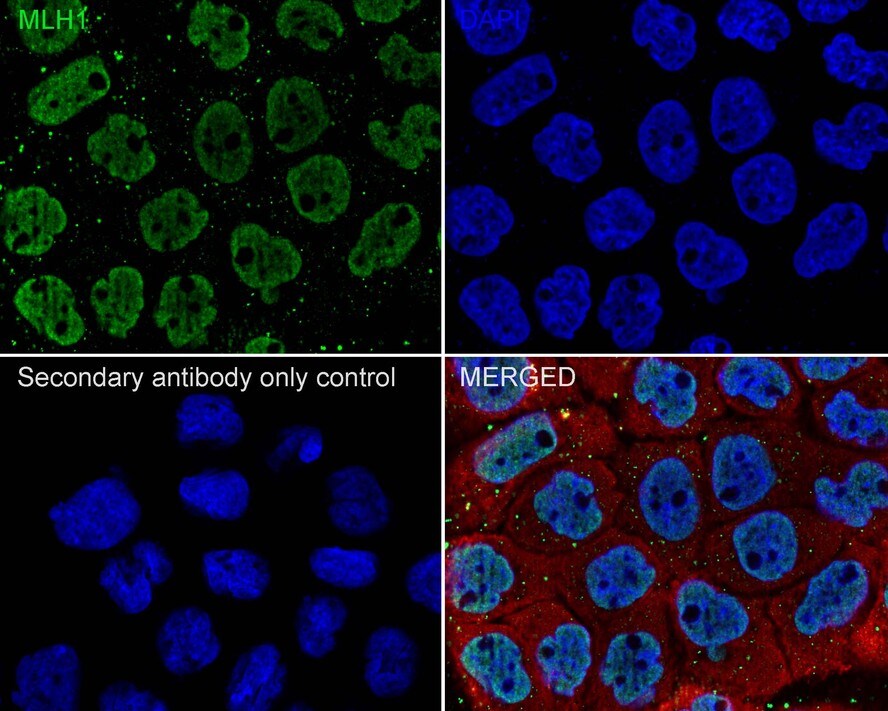 MLH1 Antibody (PSH01-74)