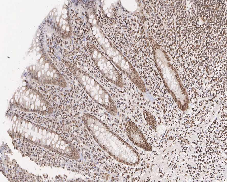 MLH1 Antibody (PSH01-74)