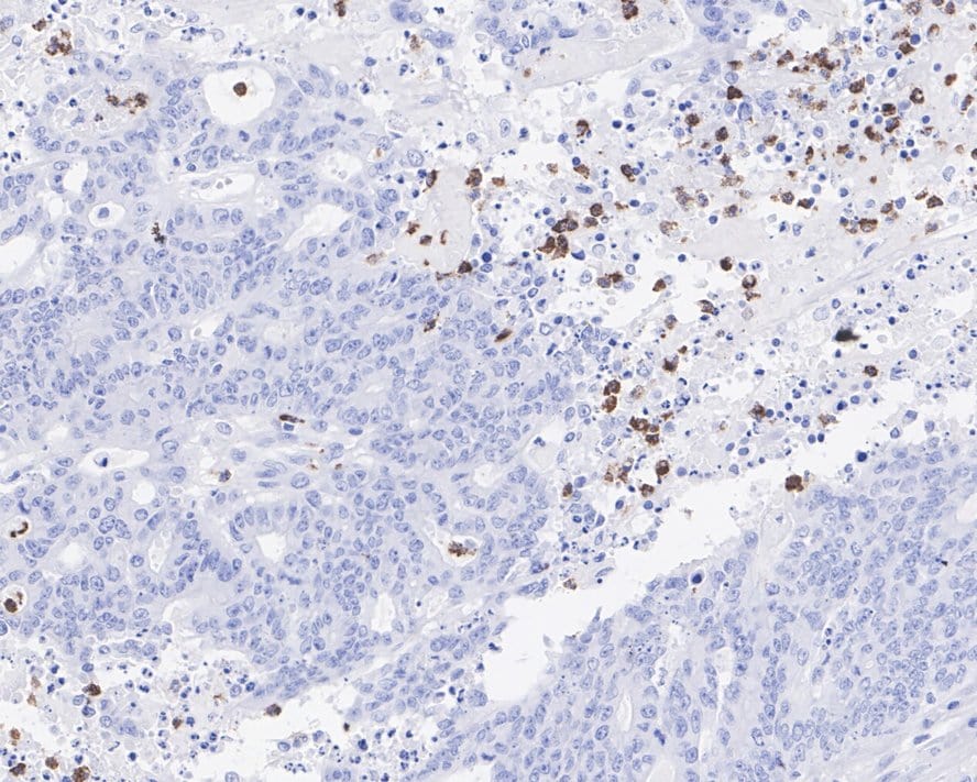 MMP-8 Antibody (JE59-38)
