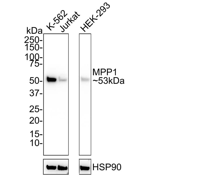 MPP1 Antibody (PSH02-69)