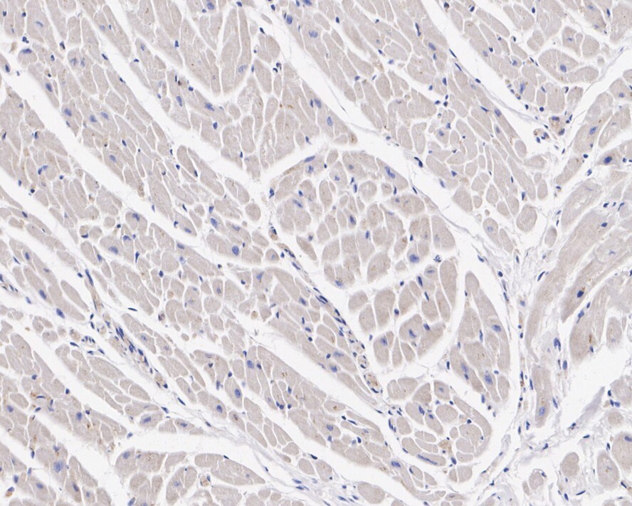 MPP1 Antibody (PSH02-69)