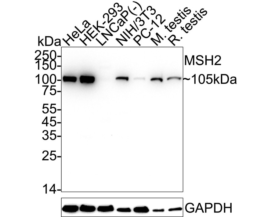 MSH2 Antibody (10G3-R) Western Blot: MSH2 Antibody (10G3-R) [NBP3-32604]