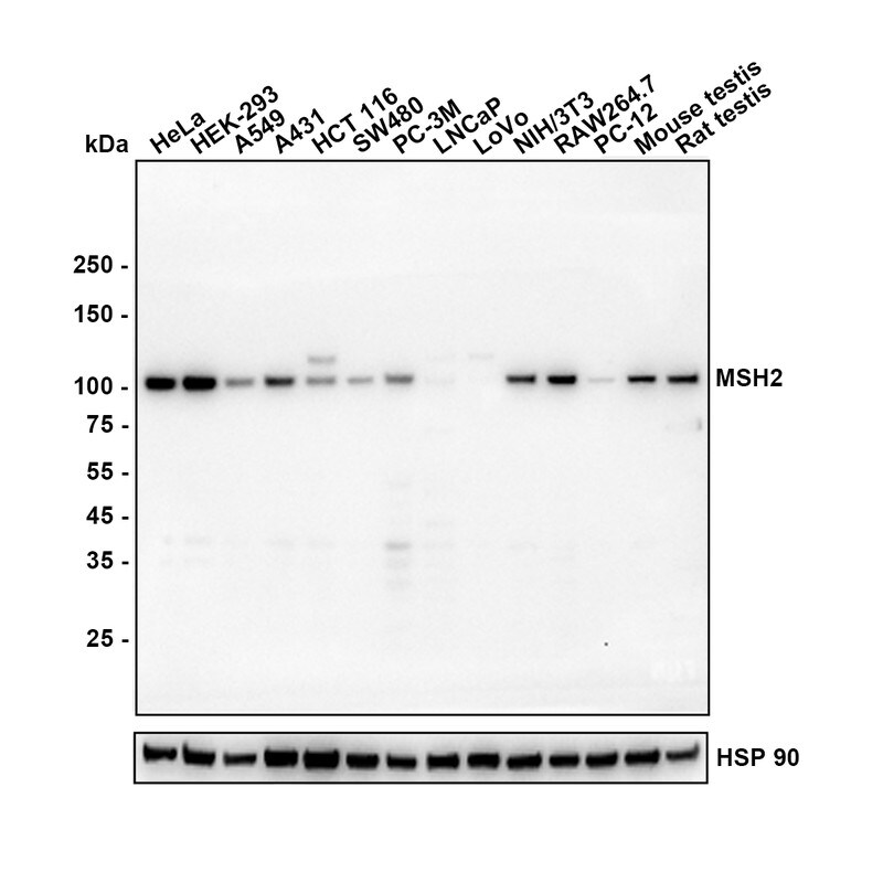 MSH2 Antibody (10G2-R) Western Blot: MSH2 Antibody (10G2-R) [NBP3-32605]