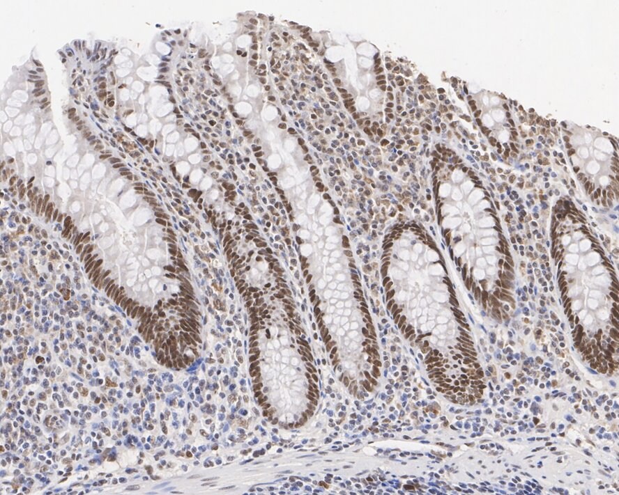 MSH2 Antibody (10G2-R)
