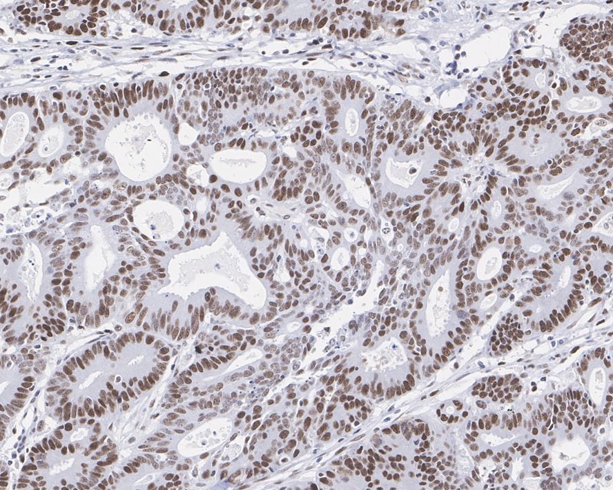 MSH6 Antibody (A4C4-R)
