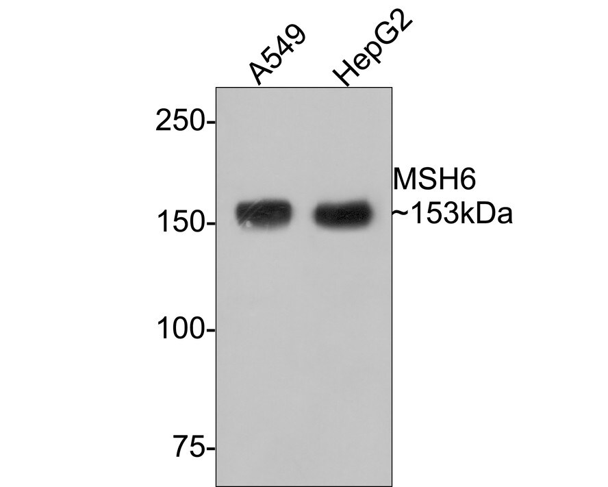MSH6 Antibody (PD00-26)