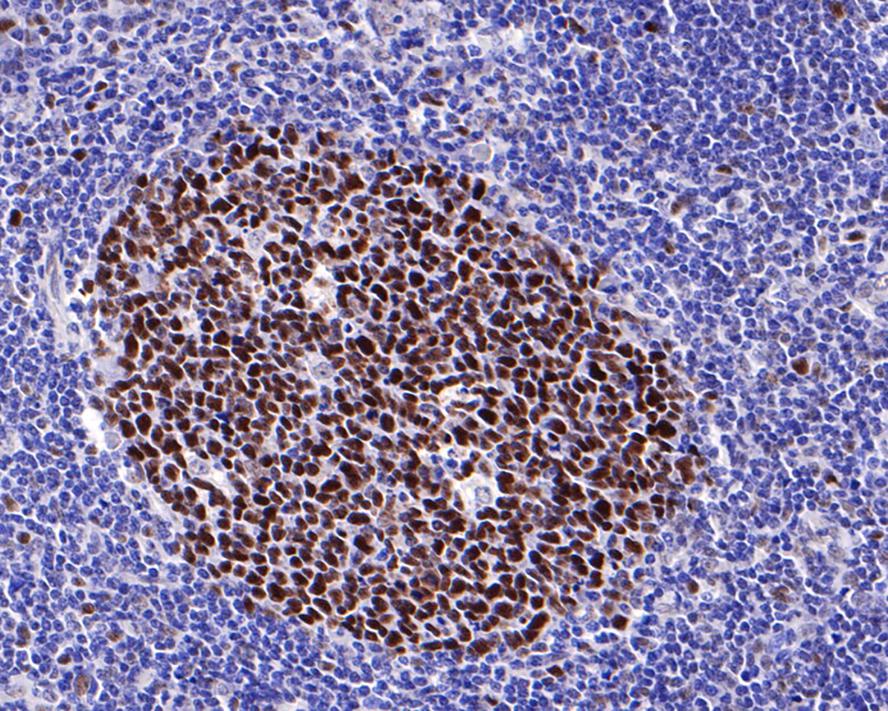MSH6 Antibody (PD00-26)
