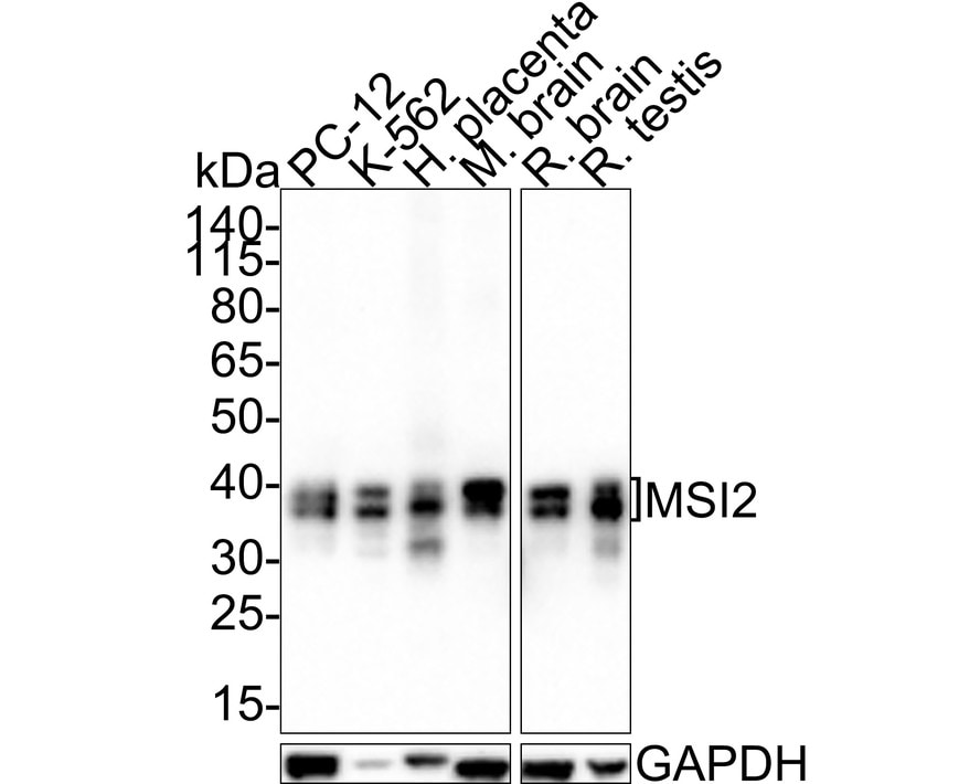 Musashi-2 Antibody (PSH01-17) Western Blot: Musashi-2 Antibody (PSH01-17) [NBP3-32608]
