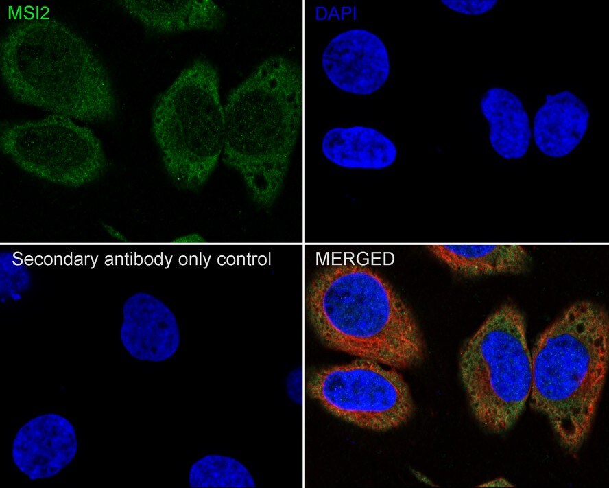 Musashi-2 Antibody (PSH01-17)