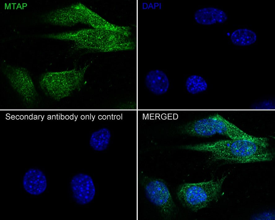 MTAP Antibody (JE63-74)