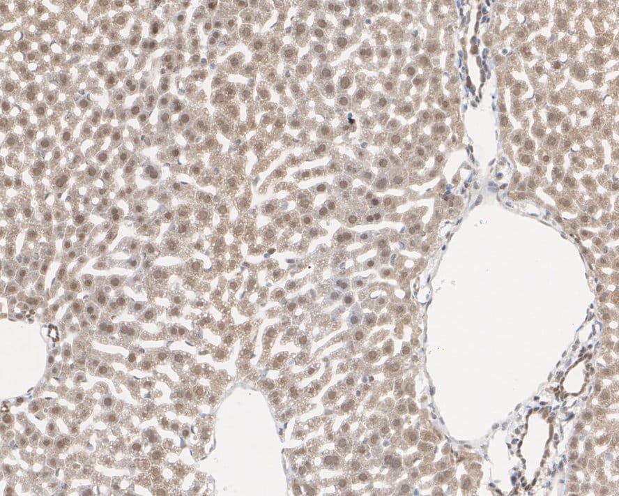 MTAP Antibody (JE63-74)
