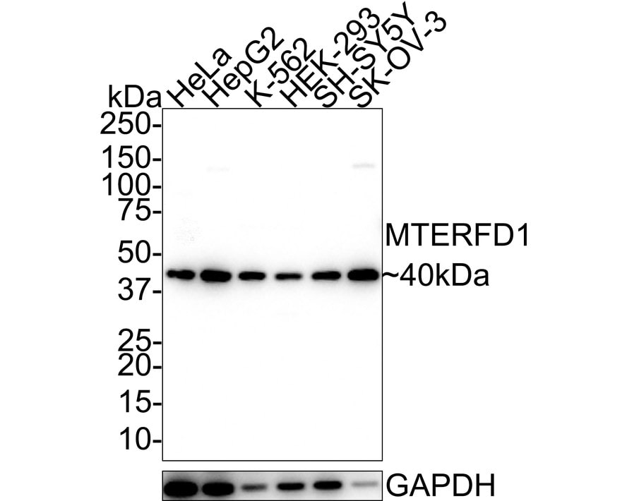 MTERFD1 Antibody (A8-A10-R) Western Blot: MTERFD1 Antibody (A8-A10-R) [NBP3-32611]