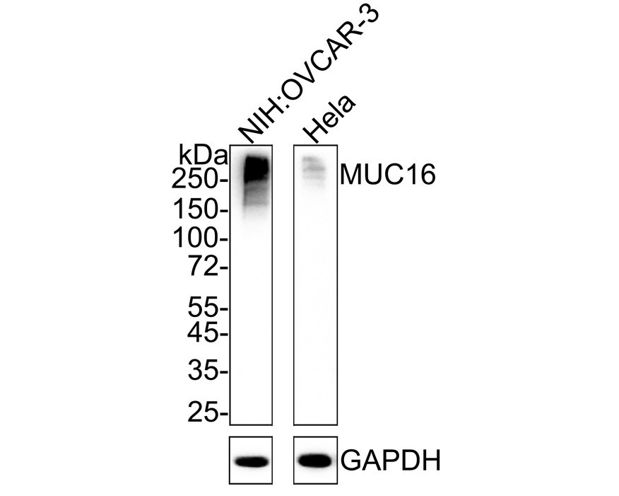 CA125/MUC16 Antibody (PD01-13) Western Blot: CA125/MUC16 Antibody (PD01-13) [NBP3-32614]