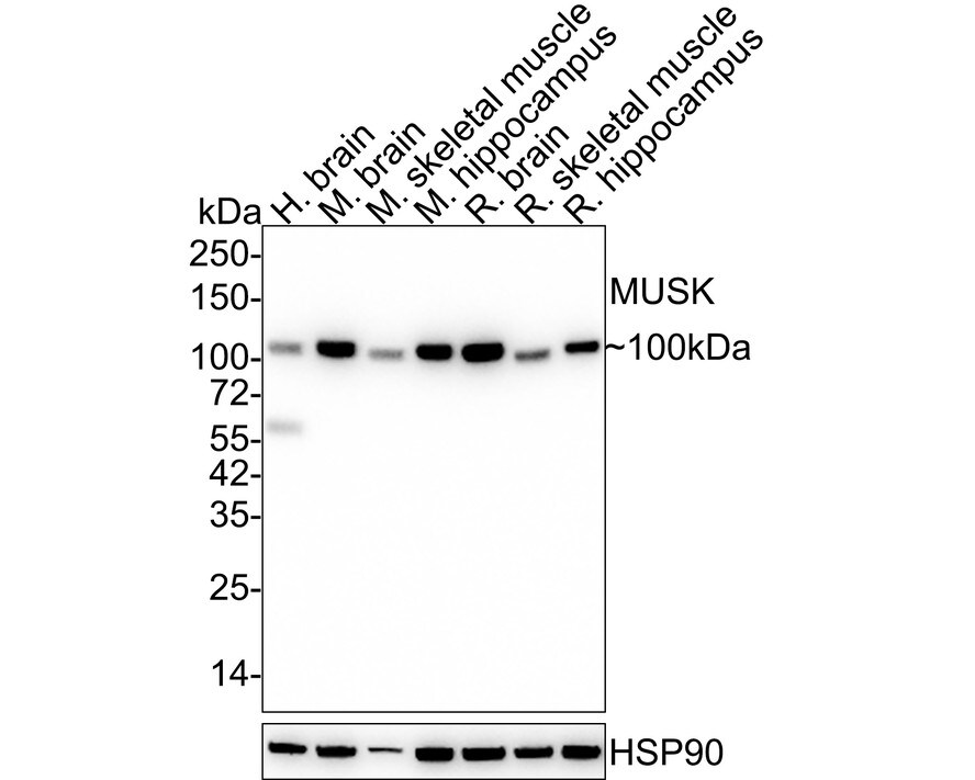 MuSK Antibody (PSH03-51) Western Blot: MuSK Antibody (PSH03-51) [NBP3-32620]