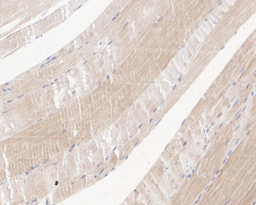 MuSK Antibody (PSH03-51)