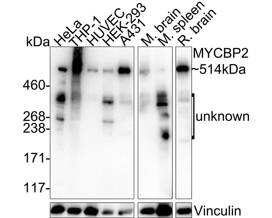 MYCBP2 Antibody (PSH03-68)
