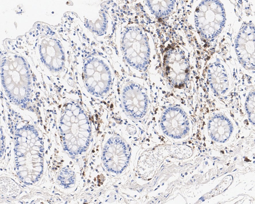 Myeloperoxidase/MPO Antibody (A1F2-R)